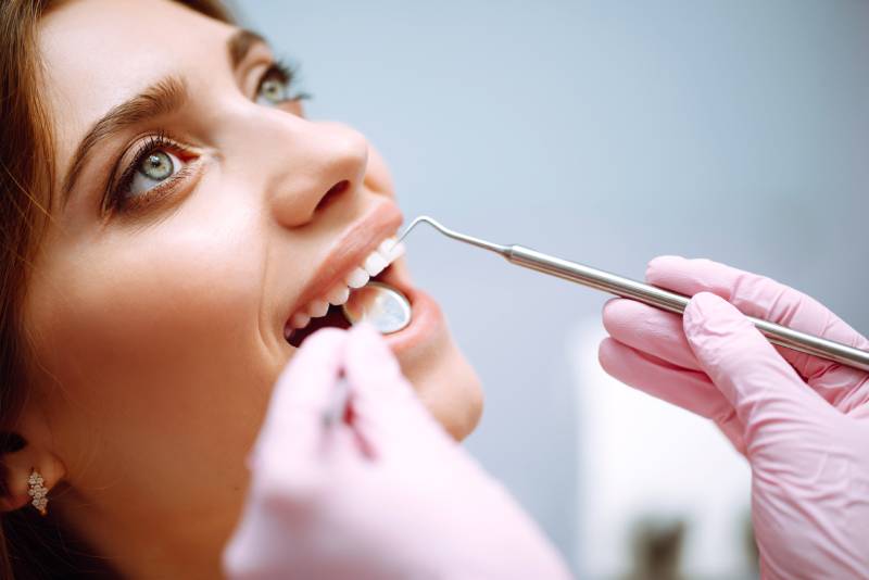 Especialistas en carillas dentales cuidado y seguimiento