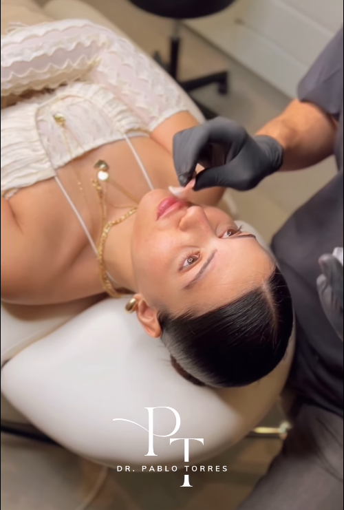 proceso relleno de surco nasogeniano